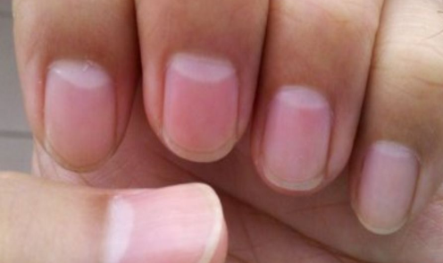 指甲上的“月牙”越多越健康？